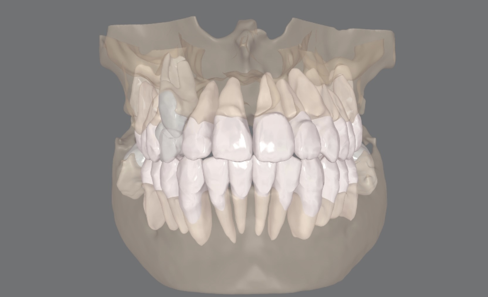 Zdjęcie cbct